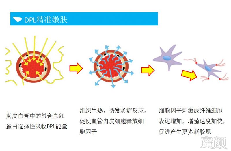 https://img.miyanlife.com/mnt/timg/190503/1020404F9-5.jpg