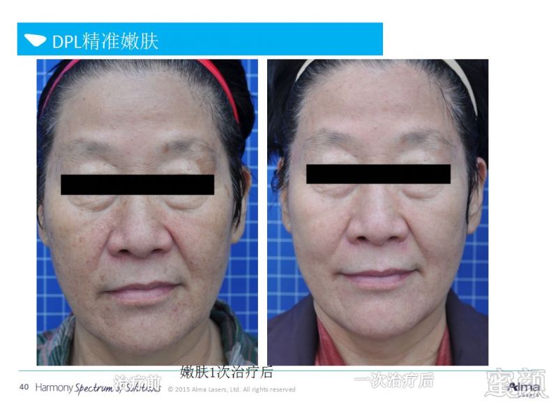 https://img.miyanlife.com/mnt/timg/190503/1020414J4-6.jpg