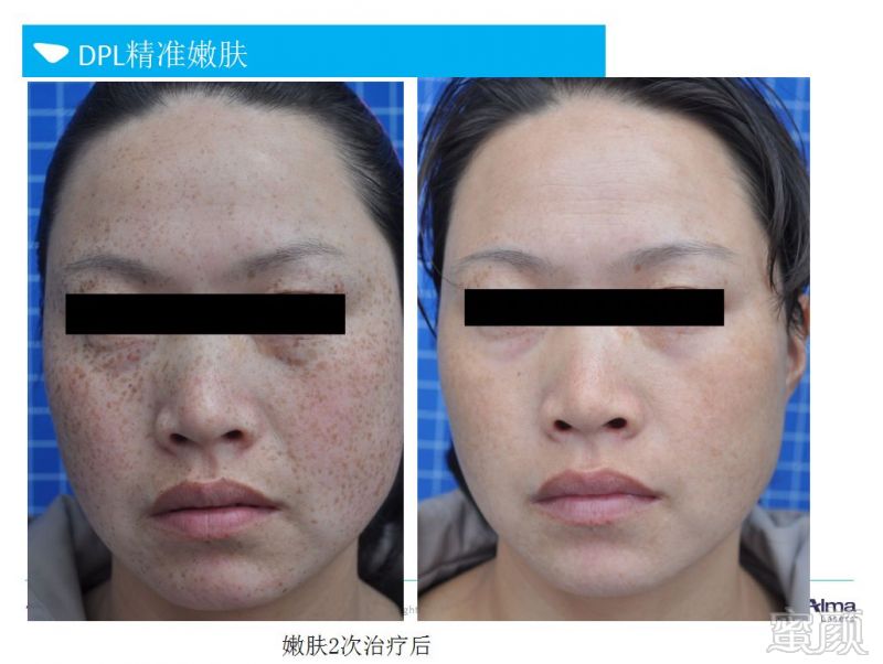 https://img.miyanlife.com/mnt/timg/190503/10204CU5-8.jpg