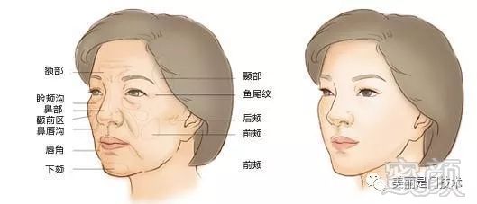 https://img.miyanlife.com/mnt/timg/190503/1021303019-1.jpg