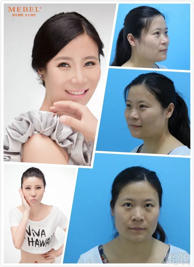 https://img.miyanlife.com/mnt/timg/190503/104014HH-9.jpg