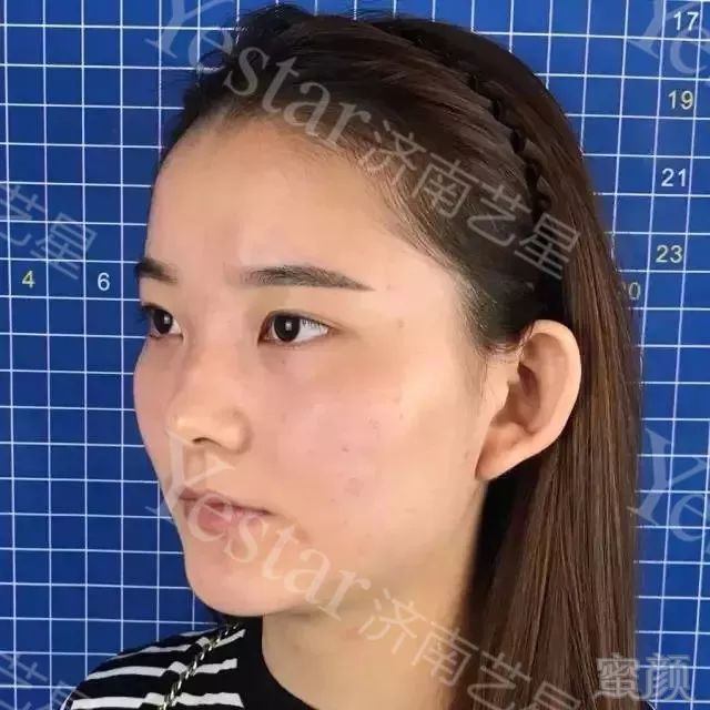 https://img.miyanlife.com/mnt/timg/190503/1100495394-12.jpg