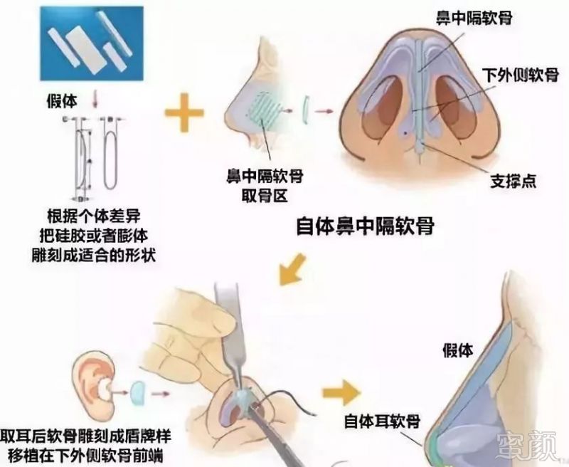 https://img.miyanlife.com/mnt/timg/190503/110Z42P3-0.jpg