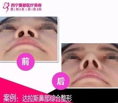 https://img.miyanlife.com/mnt/timg/190503/110Z634B-1.jpg