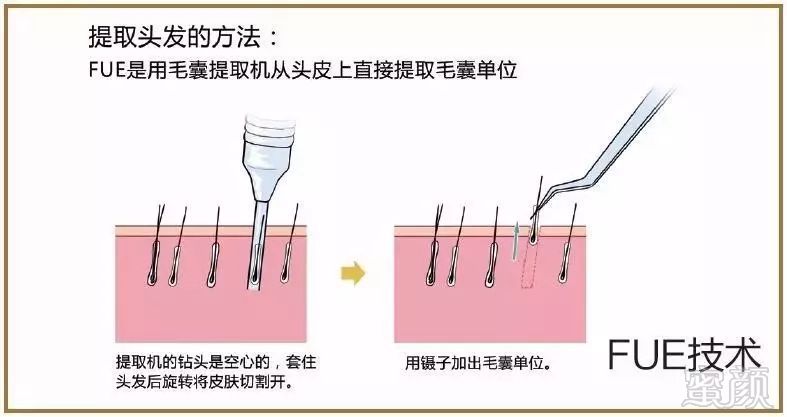 案例图片