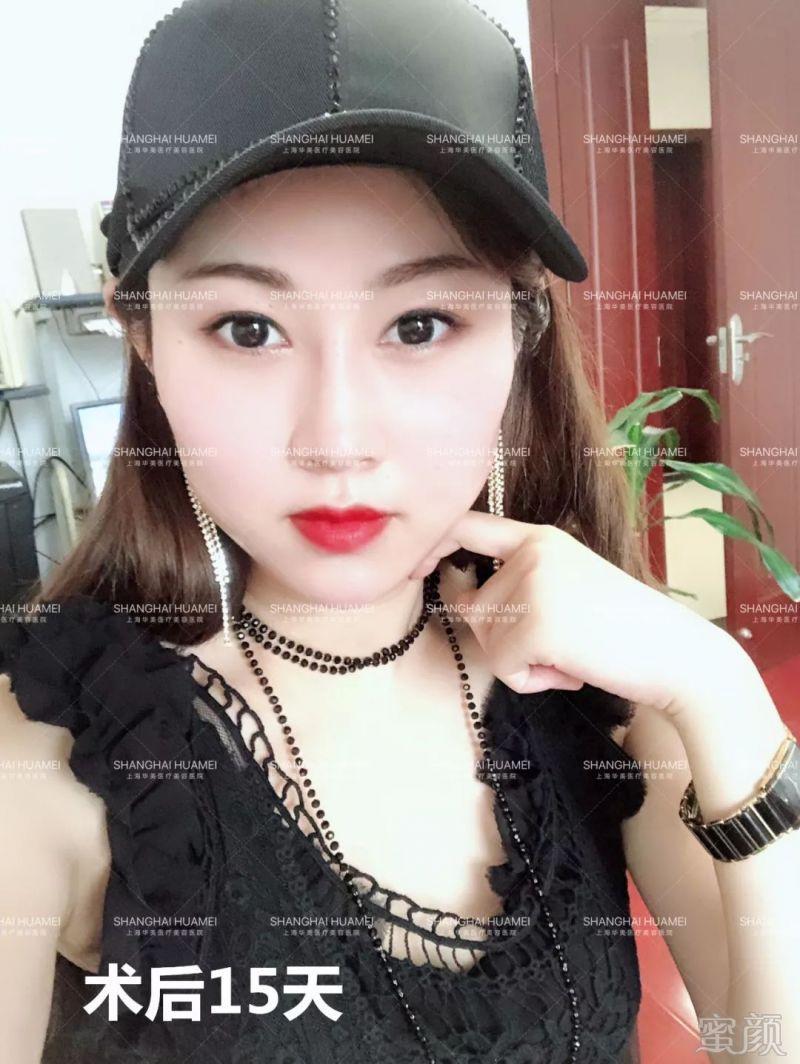 https://img.miyanlife.com/mnt/timg/190503/11230631I-11.jpg