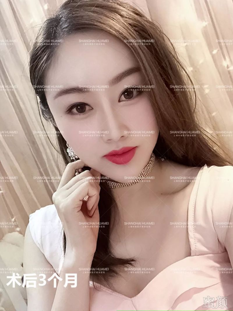 https://img.miyanlife.com/mnt/timg/190503/11231W512-14.jpg