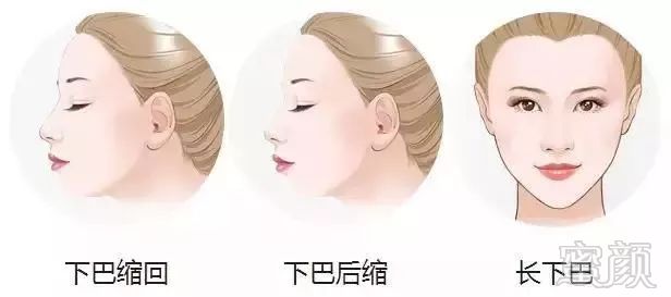 https://img.miyanlife.com/mnt/timg/190504/105J94924-12.jpg