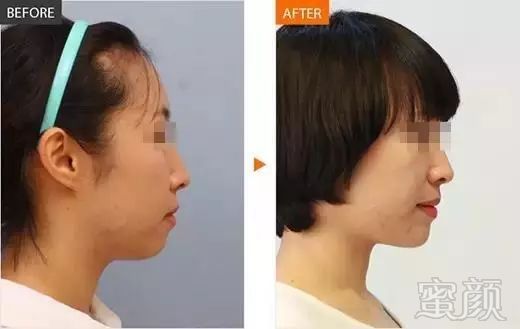 https://img.miyanlife.com/mnt/timg/190504/105K05B0-15.jpg