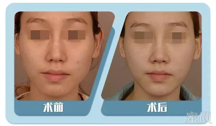 https://img.miyanlife.com/mnt/timg/190505/104P15W3-3.jpg