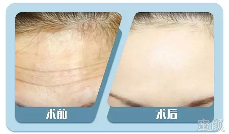 https://img.miyanlife.com/mnt/timg/190505/104P464V-5.jpg