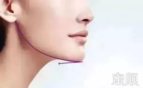 https://img.miyanlife.com/mnt/timg/190505/104P61308-6.jpg