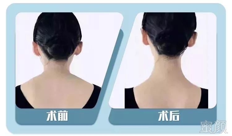 https://img.miyanlife.com/mnt/timg/190505/104P9DP-9.jpg