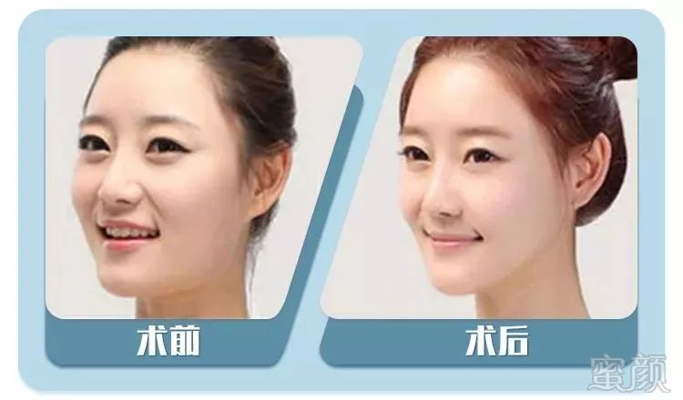 https://img.miyanlife.com/mnt/timg/190505/104PJ426-7.jpg