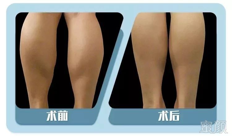 https://img.miyanlife.com/mnt/timg/190505/104R21b3-11.jpg