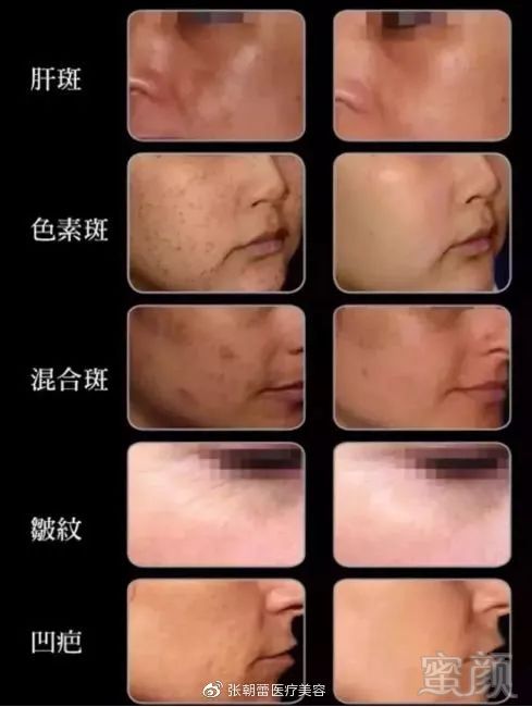https://img.miyanlife.com/mnt/timg/190505/1052362b0-5.jpg