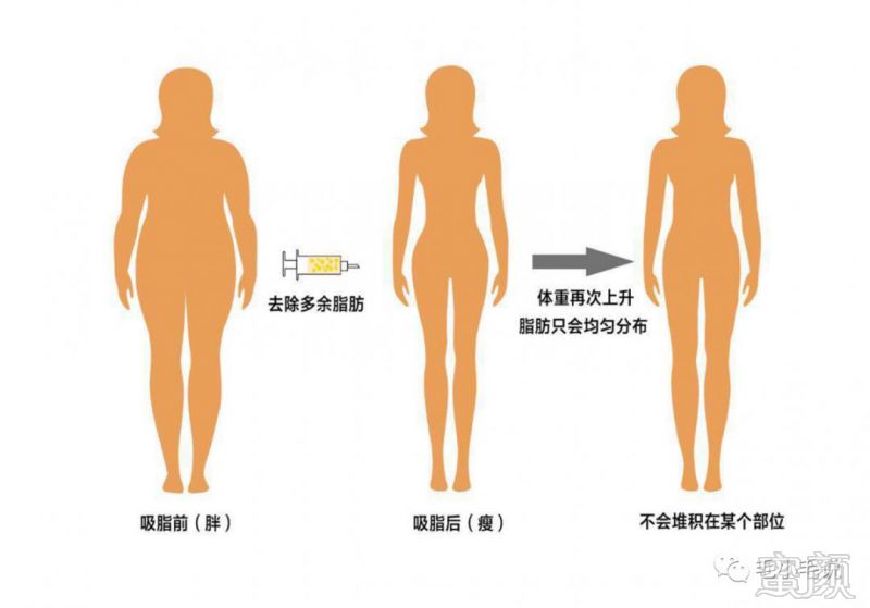 https://img.miyanlife.com/mnt/timg/190505/112Q431W-2.jpg