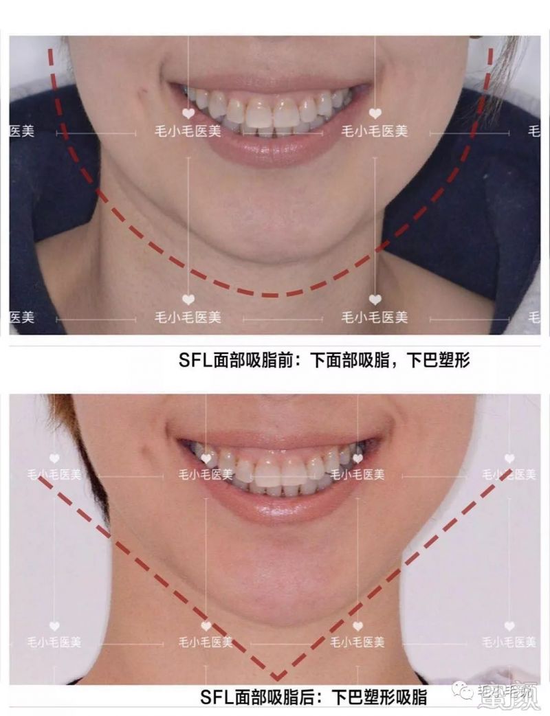 https://img.miyanlife.com/mnt/timg/190505/112Q5CC-4.jpg