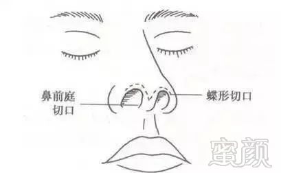 https://img.miyanlife.com/mnt/timg/190506/1153564E1-5.jpg