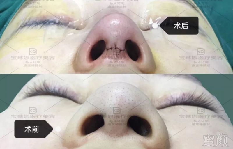 https://img.miyanlife.com/mnt/timg/190506/11535B432-4.jpg