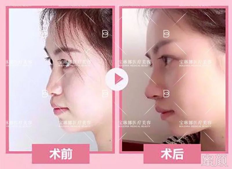 https://img.miyanlife.com/mnt/timg/190506/1154004327-7.jpg