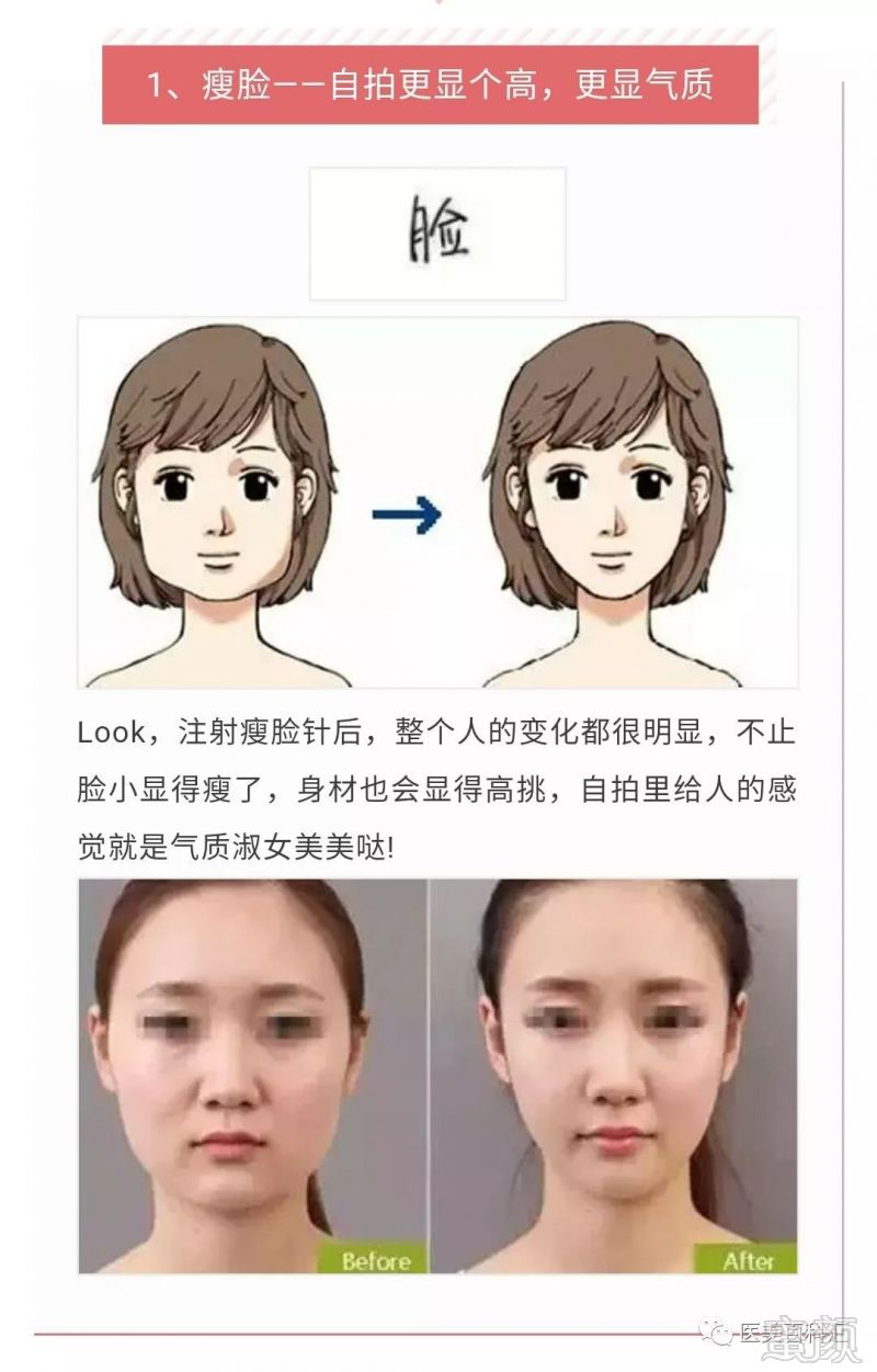 https://img.miyanlife.com/mnt/timg/190506/1211431Q6-0.jpg