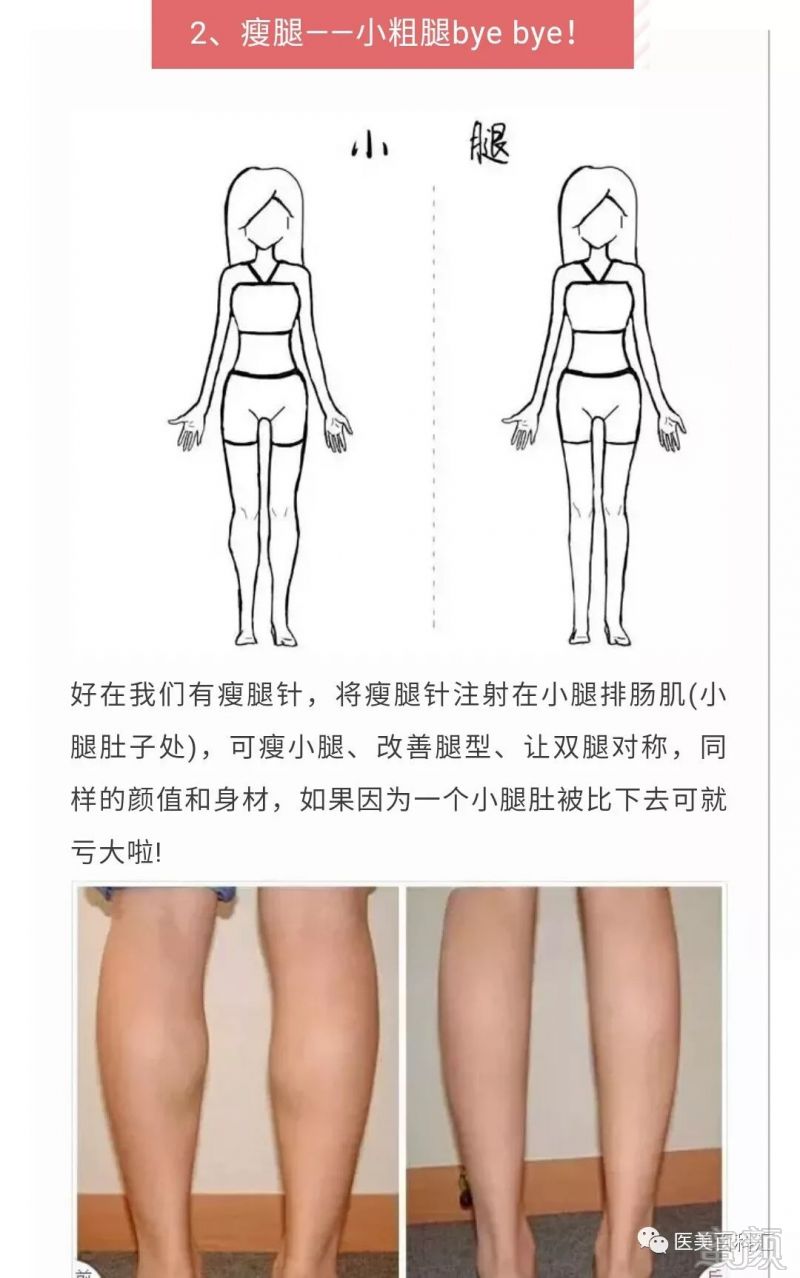 https://img.miyanlife.com/mnt/timg/190506/12114539D-1.jpg
