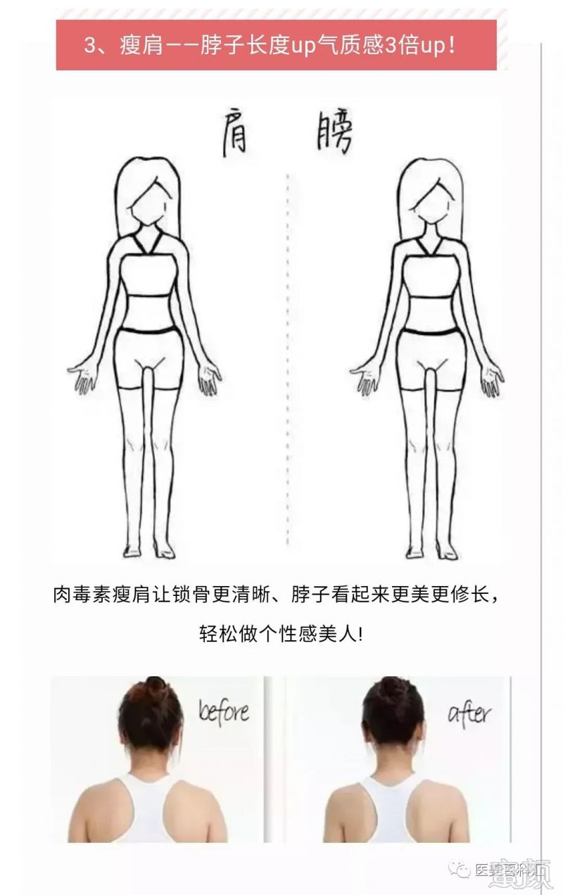 https://img.miyanlife.com/mnt/timg/190506/1211462032-2.jpg