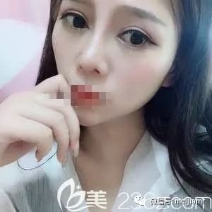 https://img.miyanlife.com/mnt/timg/190506/121UVU6-3.jpg