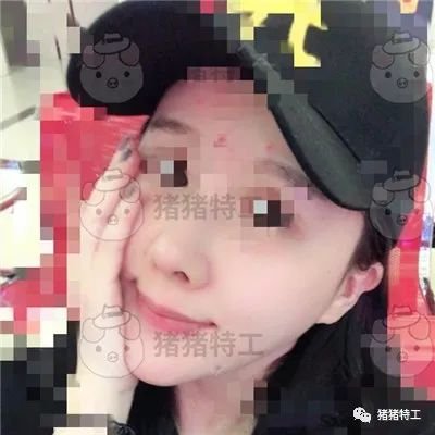 https://img.miyanlife.com/mnt/timg/190507/1110425137-6.jpg 案例图片