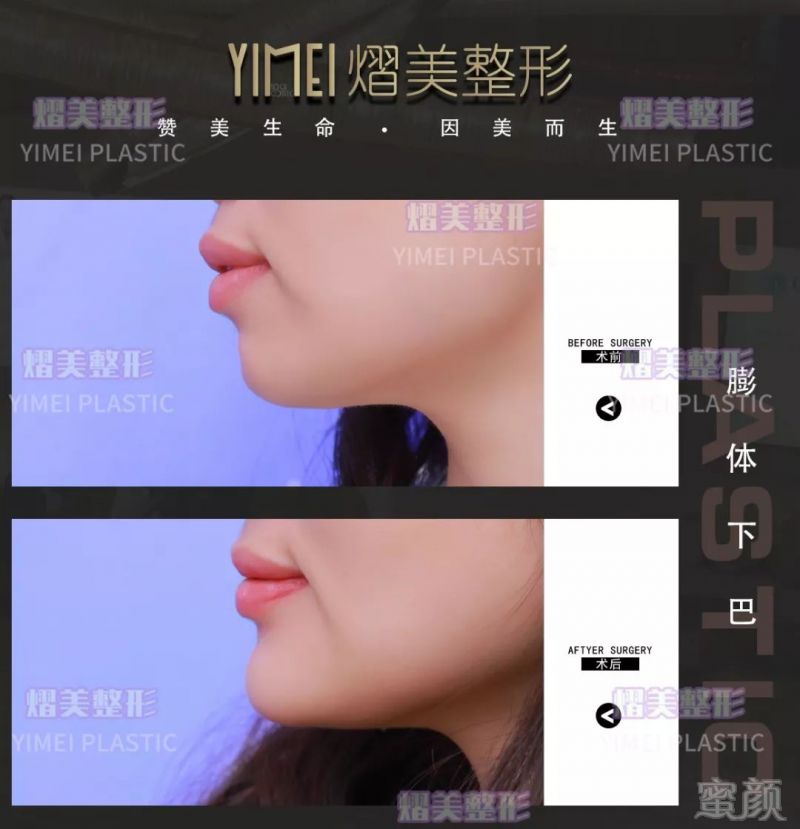 案例图片