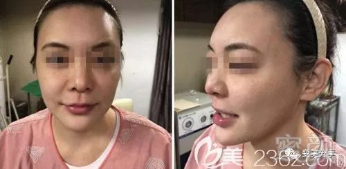 https://img.miyanlife.com/mnt/timg/190508/112U45L4-0.jpg