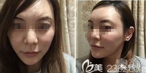 https://img.miyanlife.com/mnt/timg/190508/112U51450-3.jpg