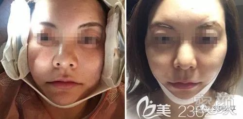 https://img.miyanlife.com/mnt/timg/190508/112U52220-1.jpg