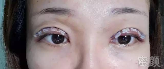 https://img.miyanlife.com/mnt/timg/190508/1134311027-3.jpg
