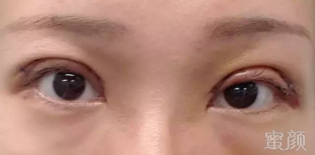 https://img.miyanlife.com/mnt/timg/190508/1134322Q5-5.jpg
