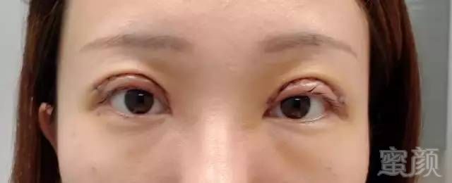 https://img.miyanlife.com/mnt/timg/190508/1134325915-6.jpg