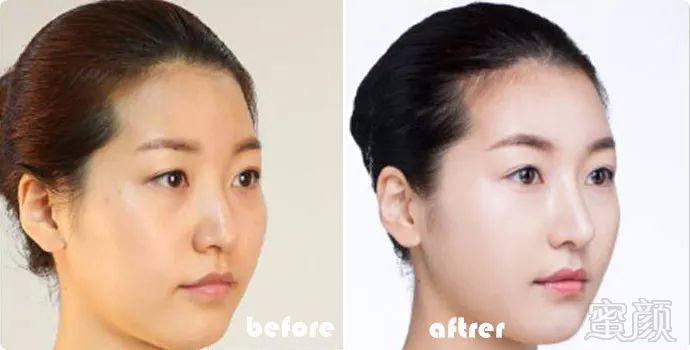 https://img.miyanlife.com/mnt/timg/190508/115J15507-2.jpg