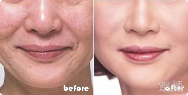 https://img.miyanlife.com/mnt/timg/190508/115J23017-4.jpg