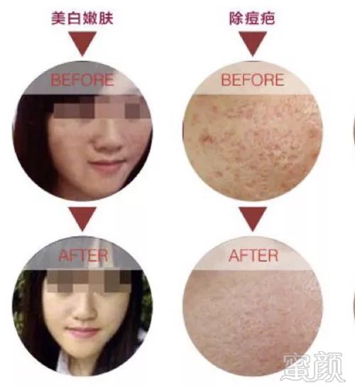 https://img.miyanlife.com/mnt/timg/190508/115J244K-5.jpg