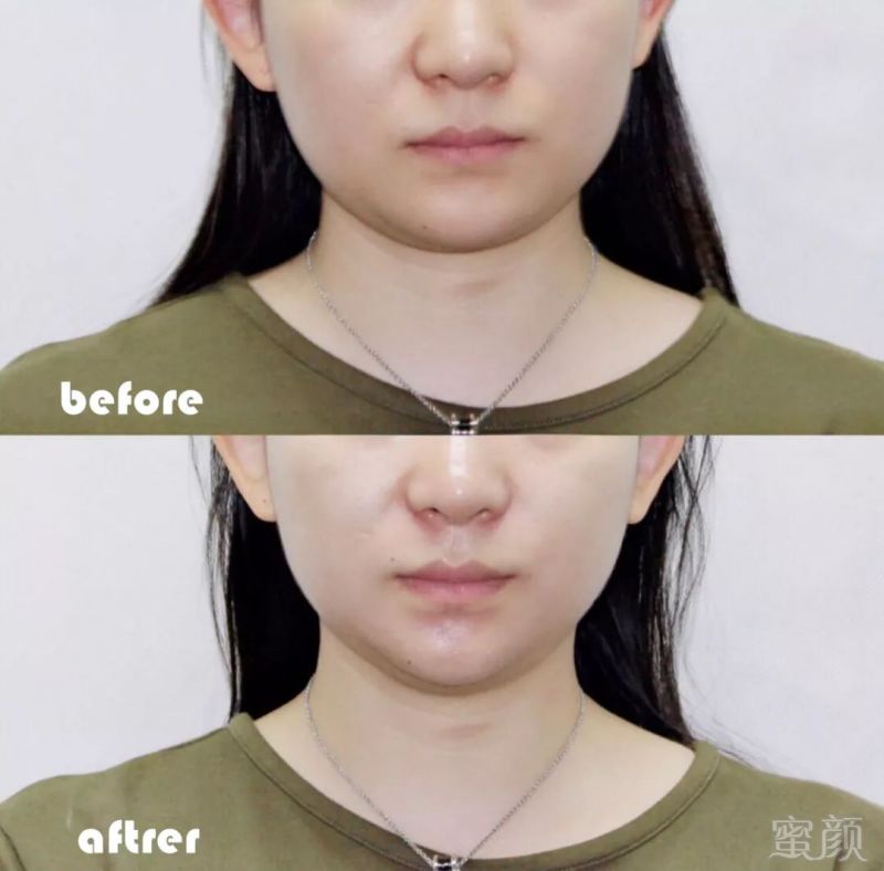 https://img.miyanlife.com/mnt/timg/190508/115J25X5-6.jpg