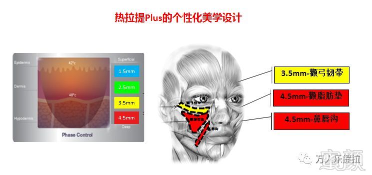 https://img.miyanlife.com/mnt/timg/190509/1145002407-10.jpg