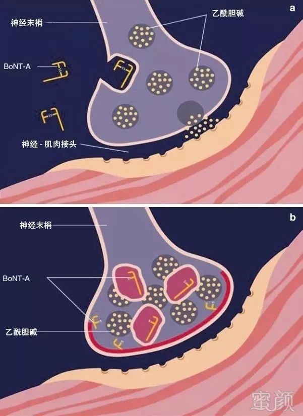 https://img.miyanlife.com/mnt/timg/190509/1150535407-0.jpg