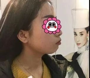 案例图片