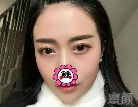 案例图片
