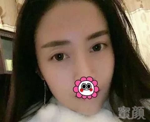 案例图片