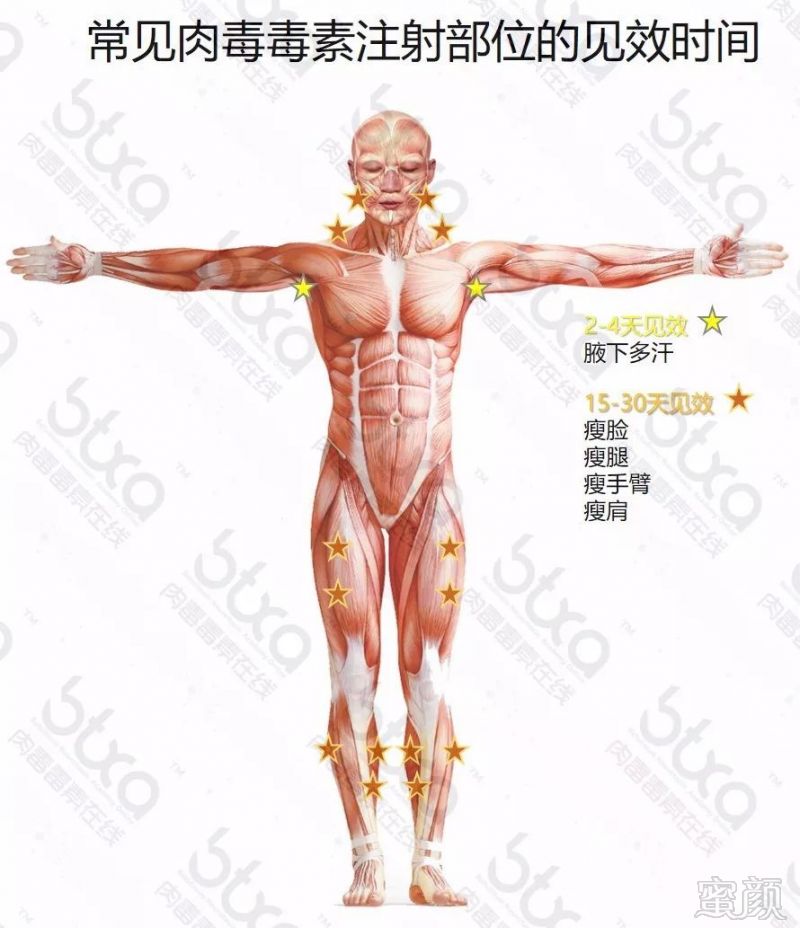 https://img.miyanlife.com/mnt/timg/190509/120GSc4-2.jpg