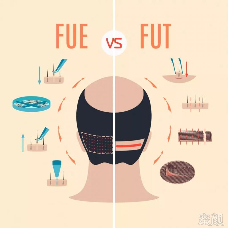 https://img.miyanlife.com/mnt/timg/190509/120U2J30-0.jpg