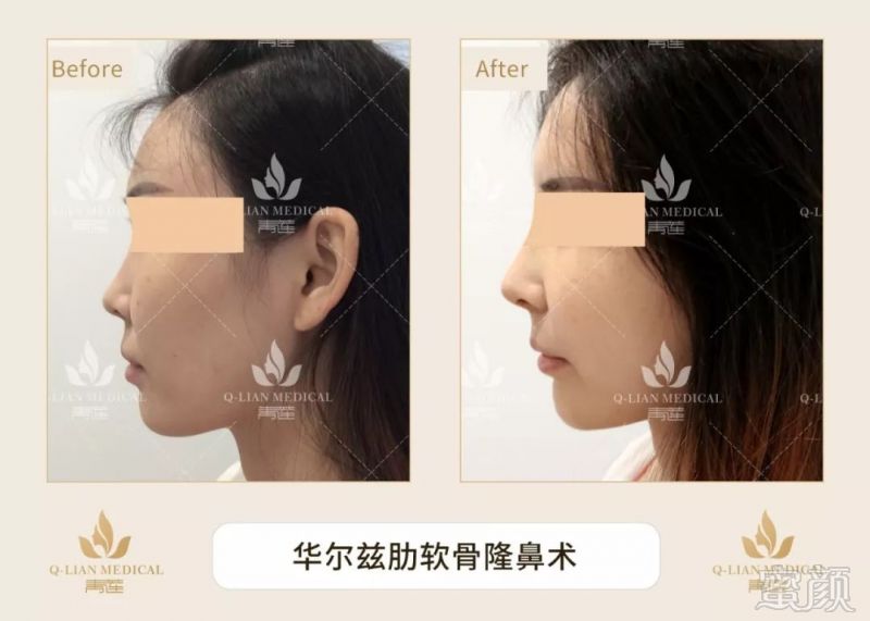 https://img.miyanlife.com/mnt/timg/190509/1221511555-8.jpg