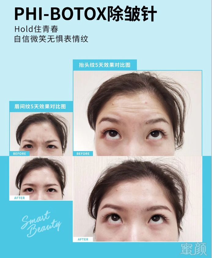 https://img.miyanlife.com/mnt/timg/190510/10553BX8-13.jpg